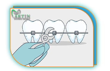 ارتودنسی دندان در کرج