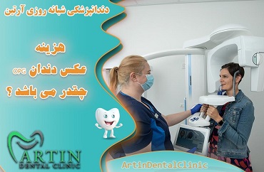 هزینه عکس دندان opg  چقدر می باشد ؟