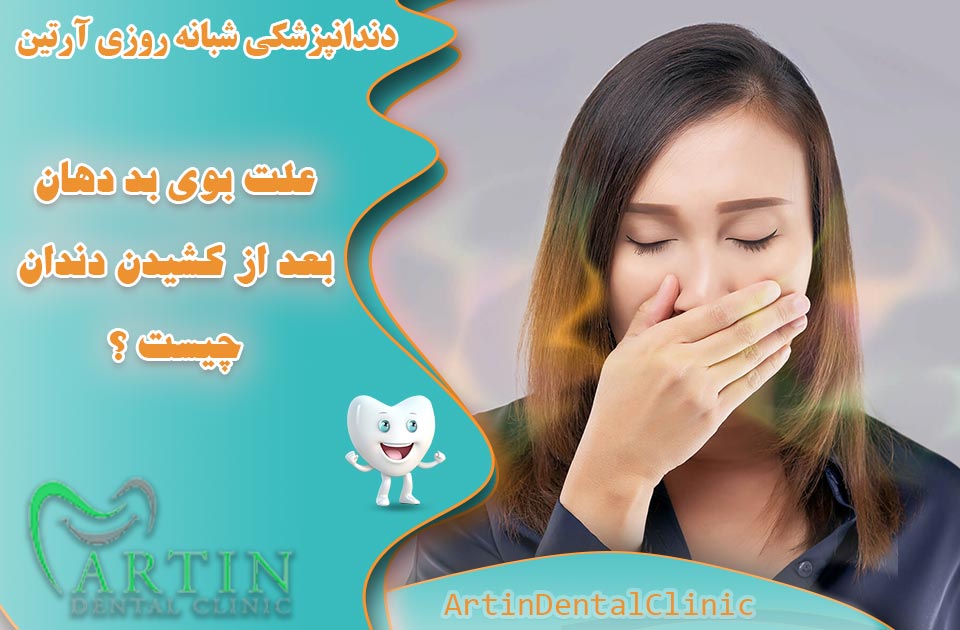 علت بوی بد دهان بعد از کشیدن دندان چیست ؟