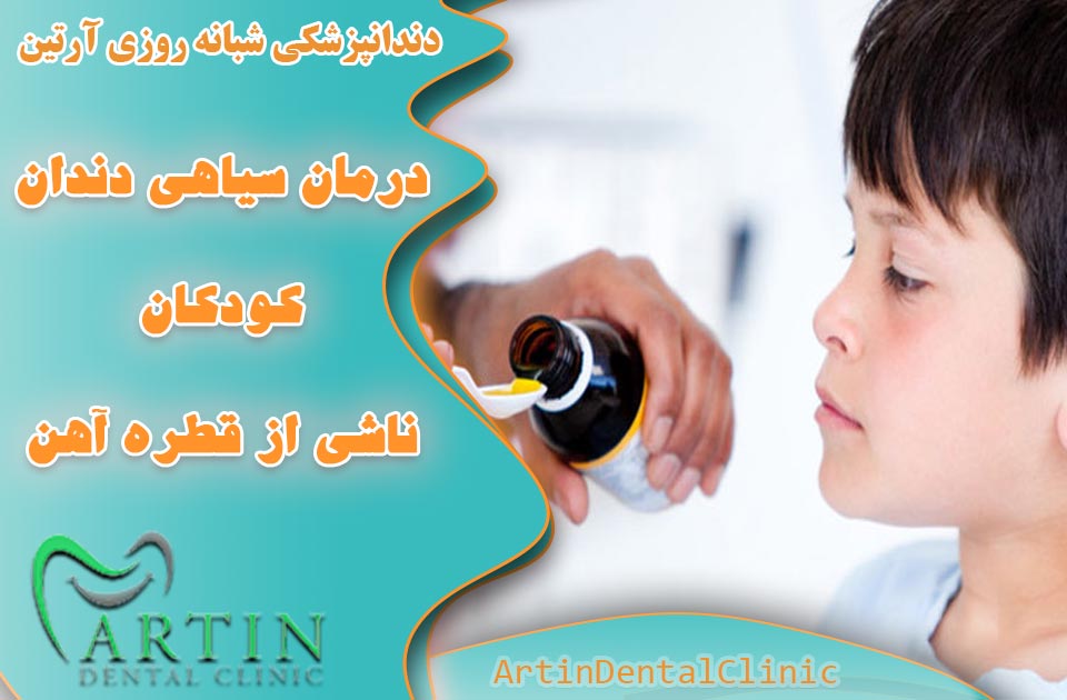 درمان و رفع سیاهی دندان کودکان ناشی از قطره آهن