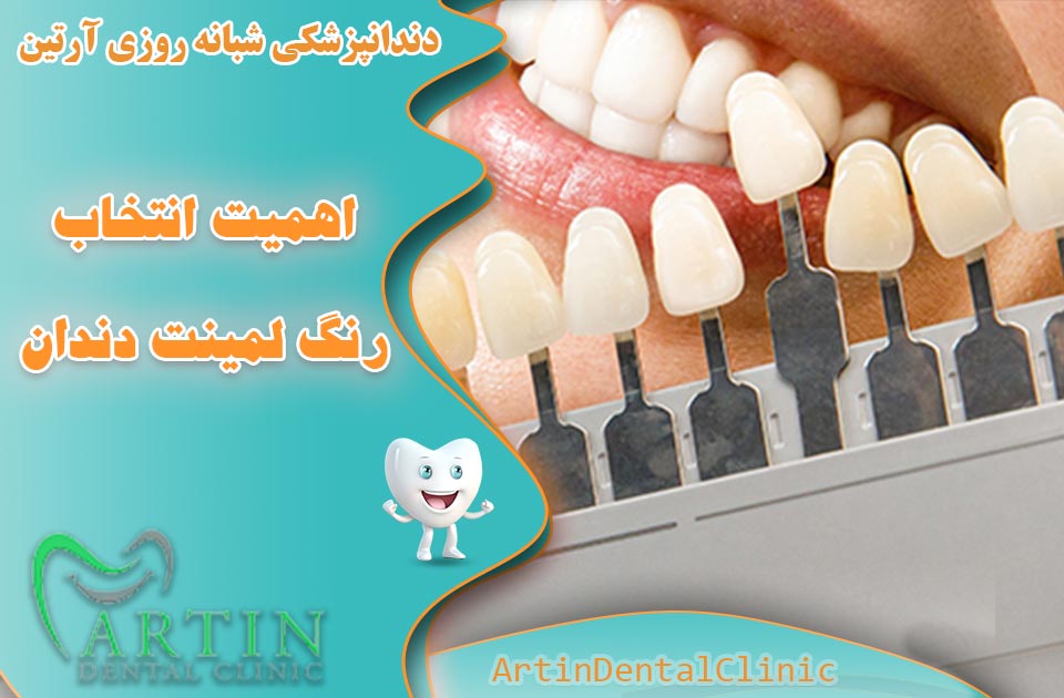 اهمیت انتخاب رنگ لمینت دندان | بهترین رنگ های محبوب