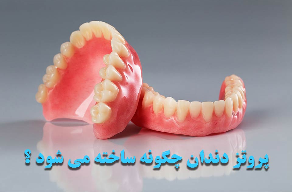 پروتز دندان چگونه ساخته می شود ؟