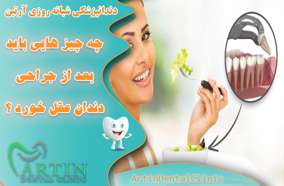چه چیز هایی باید بعد از جراحی دندان عقل بخوریم ؟ ( مفید ترین غذاها )