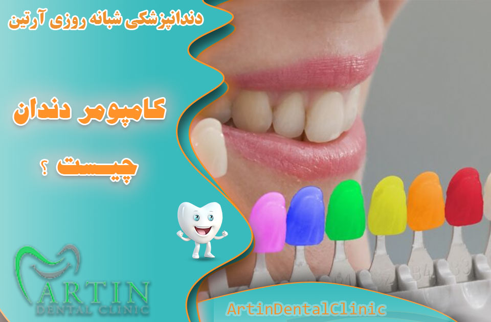 کامپومر دندان چیست ؟ یک نوآوری در دندانپزشکی