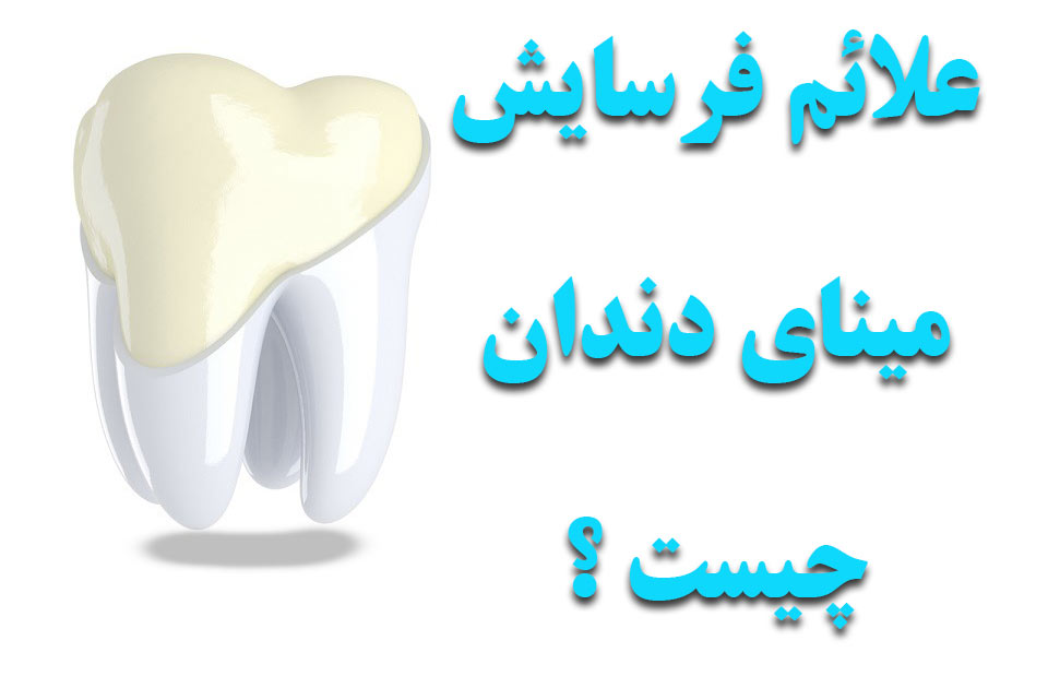 علائم فرسایش مینای دندان چیست ؟