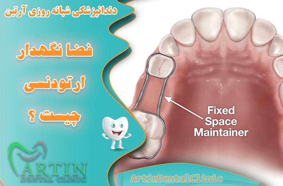 فضا نگهدار ارتودنسی چیست ؟ +کاربرد و کارایی آن