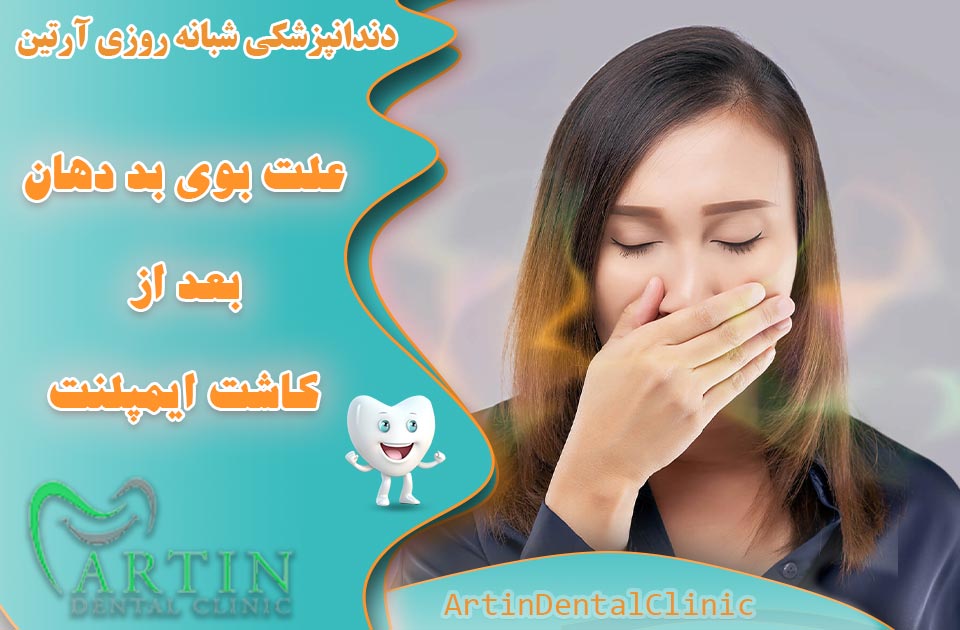 علت های مهم بوی بد دهان بعد از ایمپلنت