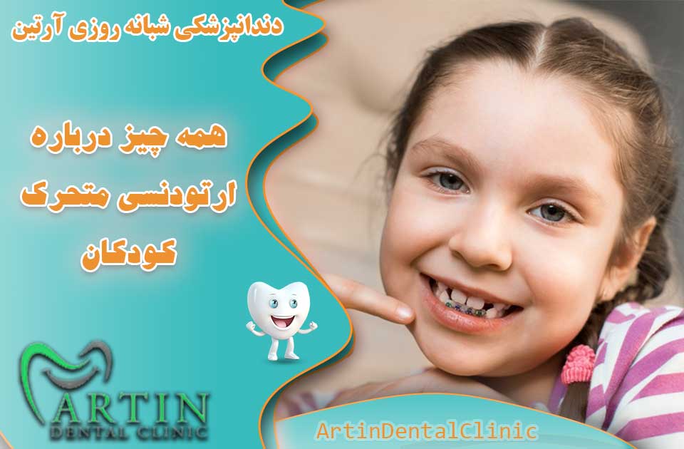 همه چیز درباره ارتودنسی متحرک برای کودکان