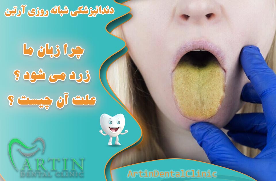 چرا زبان ما زرد می شود ؟ علت زرد شدن زبان چیست ؟