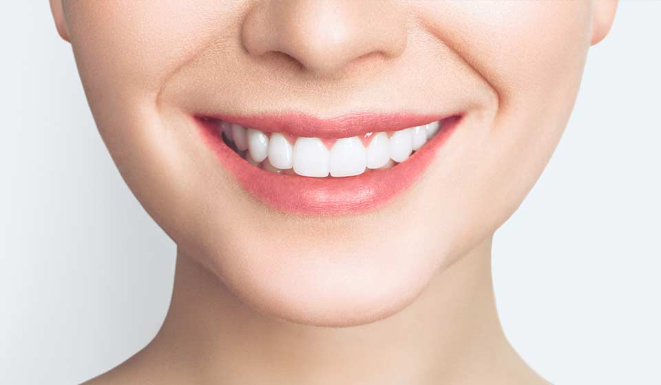 طرح لبخند چیست ؟ ( همه چیز درباره طرح لبخند )