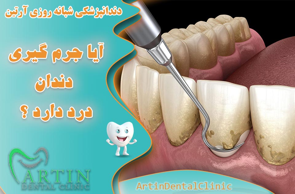 آیا جرم گیری دندان درد دارد ؟ 3 روش کاهش درد جرم گیری