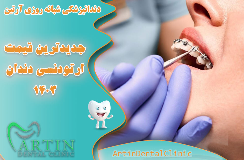 جدیدترین قیمت ارتودنسی دندان در سال 1403