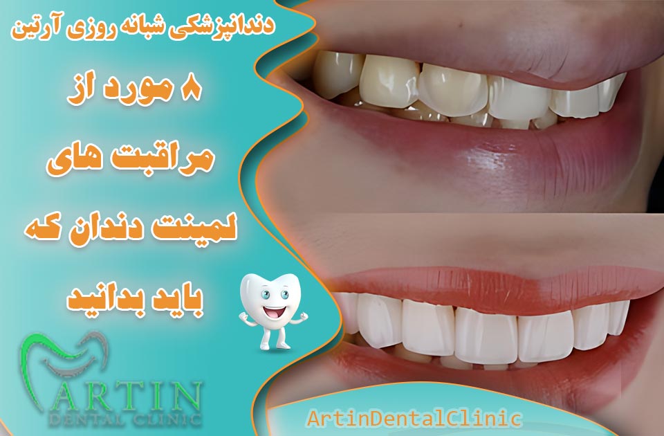 8 مورد از مراقبت های بعد از لمینت دندان که باید بدانید ( کامل و جامع )