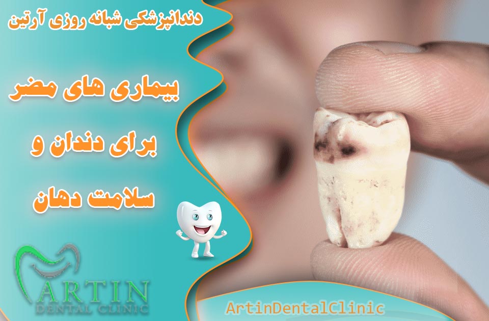 بیماری های مضر برای دندان و سلامت دهان