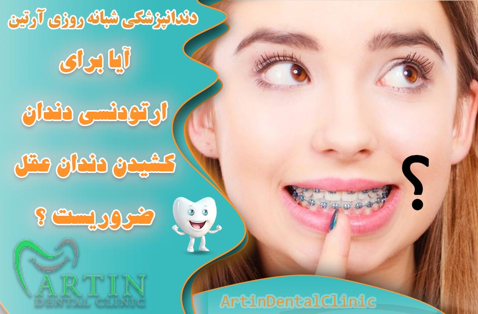 آیا برای ارتودنسی کشیدن دندان عقل ضروری است؟