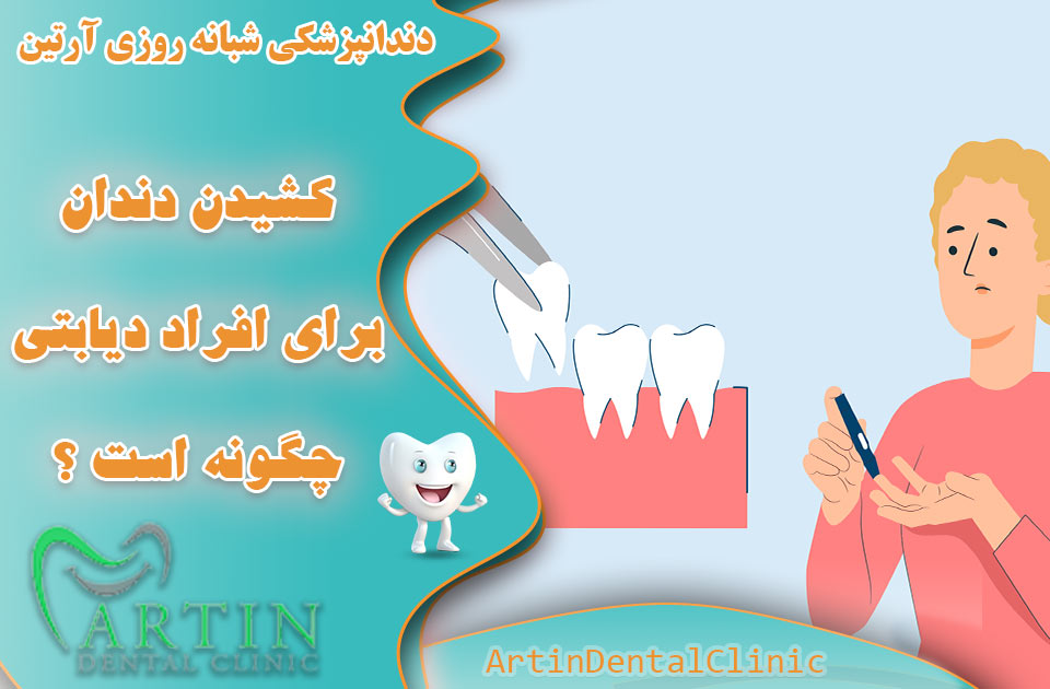 کشیدن دندان برای بیماران دیابتی چگونه است ؟