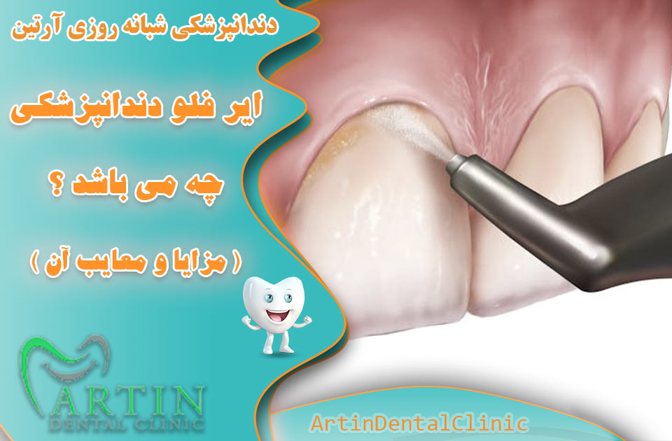 ایرفلو دندانپزشکی چه می باشد ؟ کاربرد آن چیست ؟