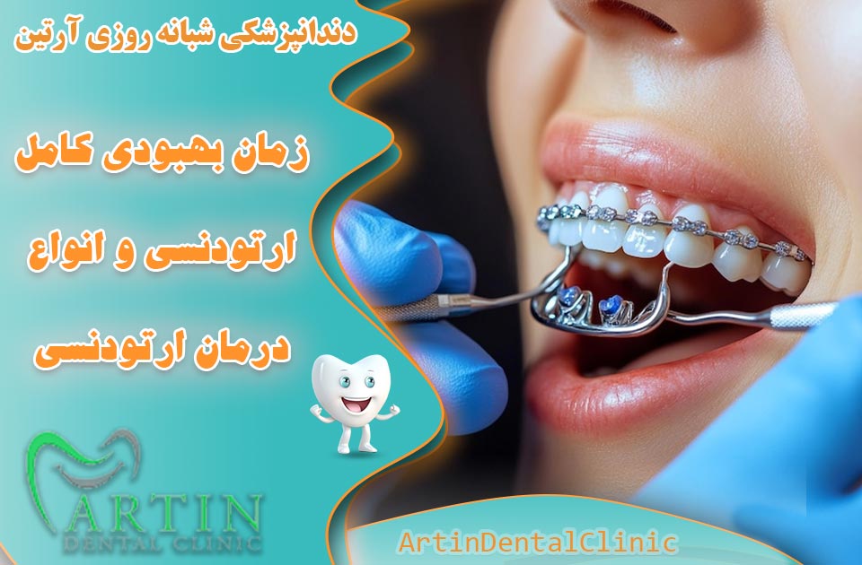 زمان بهبودی کامل ارتودنسی و انواع درمان ارتودنسی