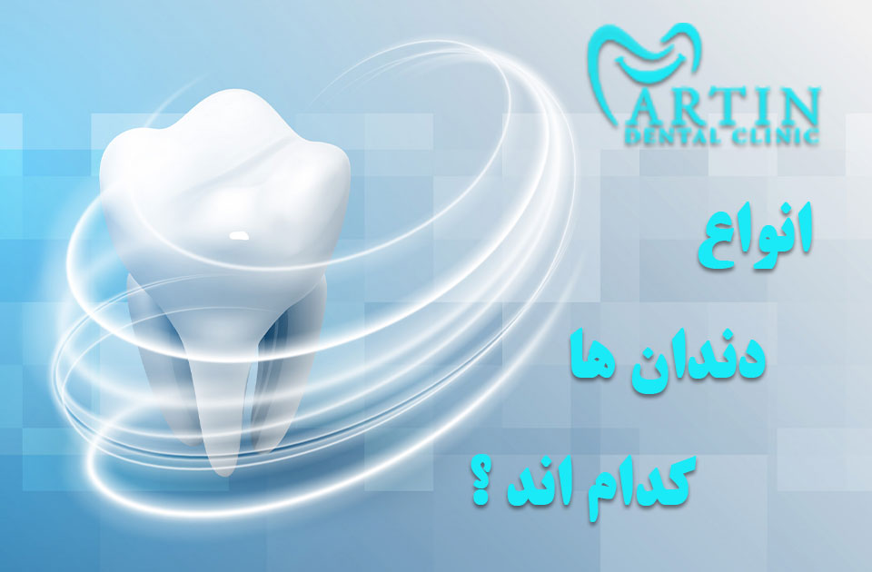 انواع دندان ها کدام اند ؟