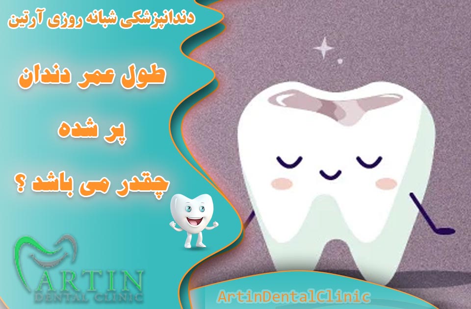 طول عمر دندان ‌های پرشده چقدر می باشد ؟