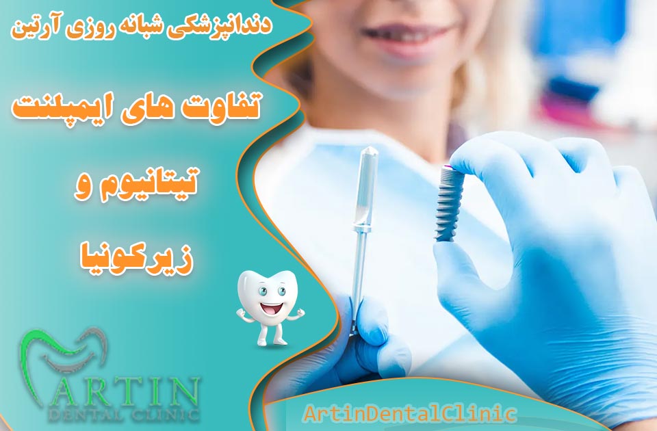 تفاوت ایمپلنت تیتانیوم و ایمپلنت زیرکونیا