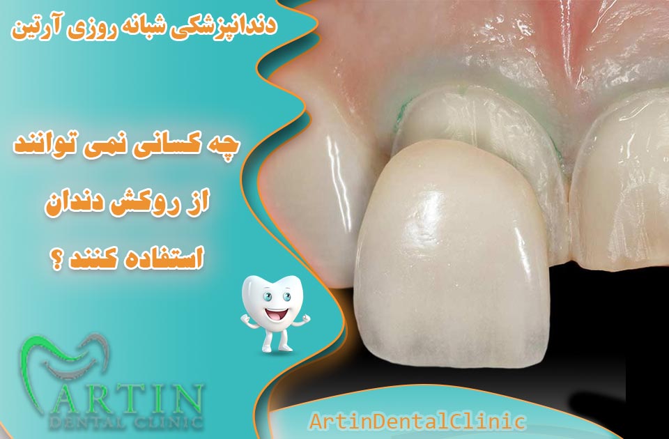 چه کسانی نباید از روکش دندان استفاده کنند ؟