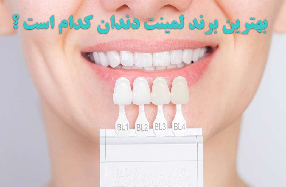 بهترین برند لمینت کدام است ؟