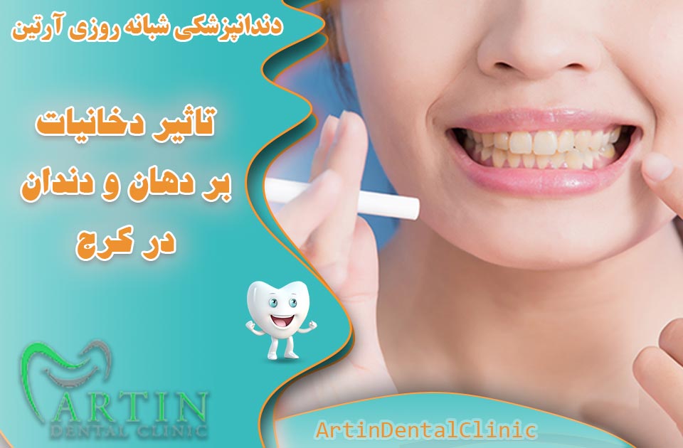 تاثیر دخانیات بر دهان و دندان در کرج