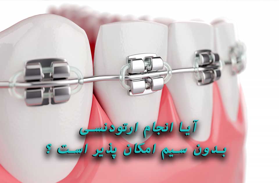 آیا انجام ارتودنسی بدون سیم امکان پذیر است ؟