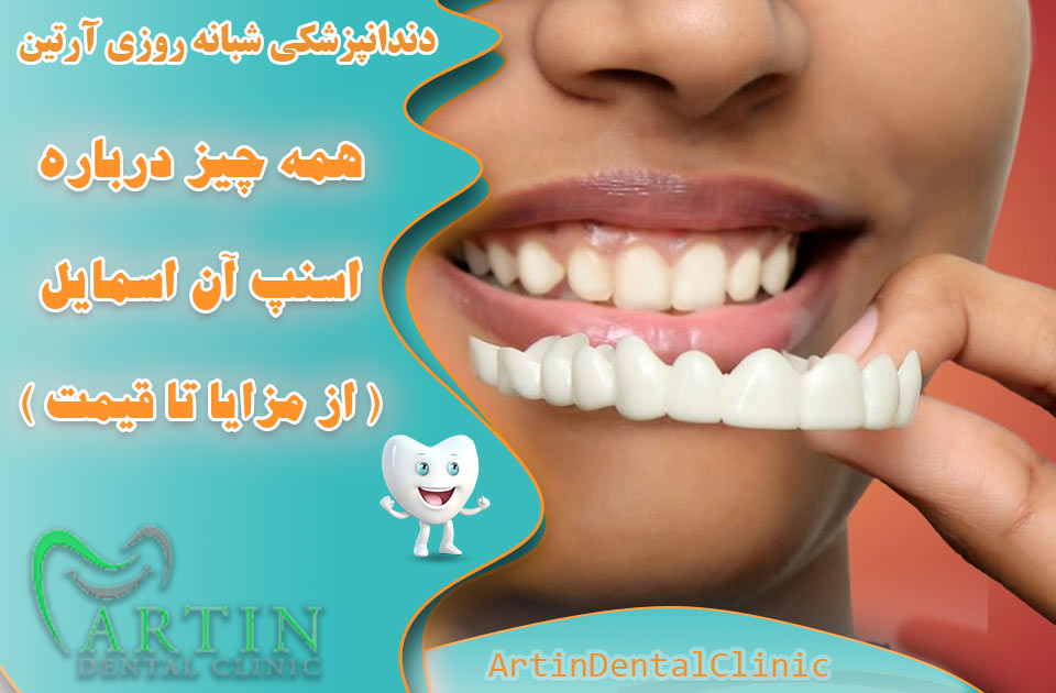 همه چیز درباره اسنپ آن اسمایل از مزایا تا قیمت آن