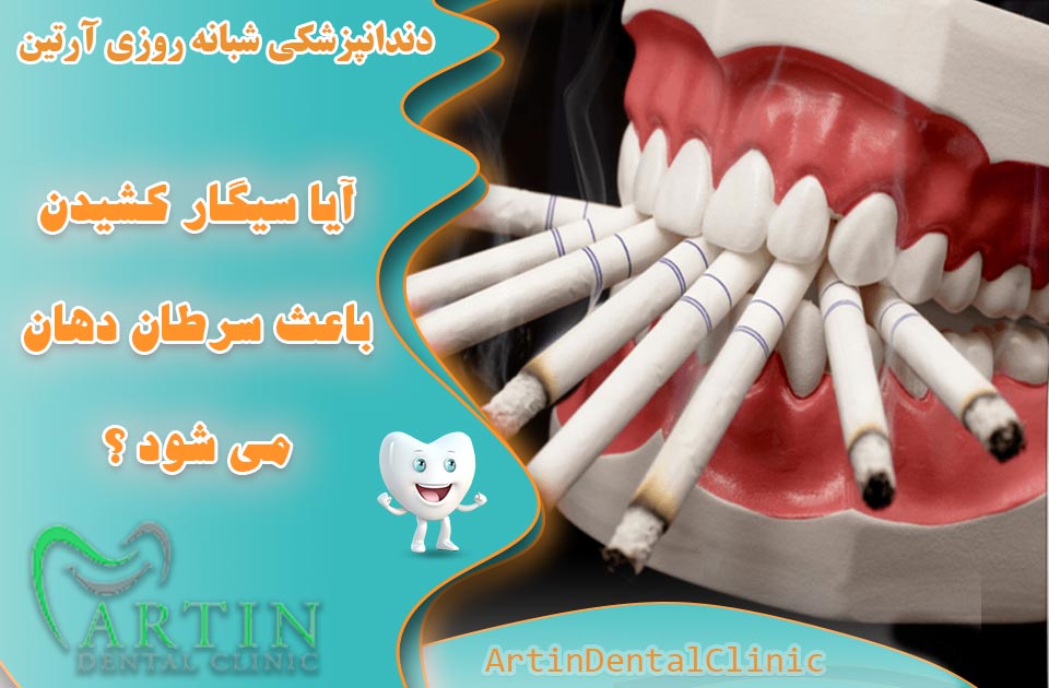 آیا سیگار کشیدن باعث سرطان دهان می شود ؟