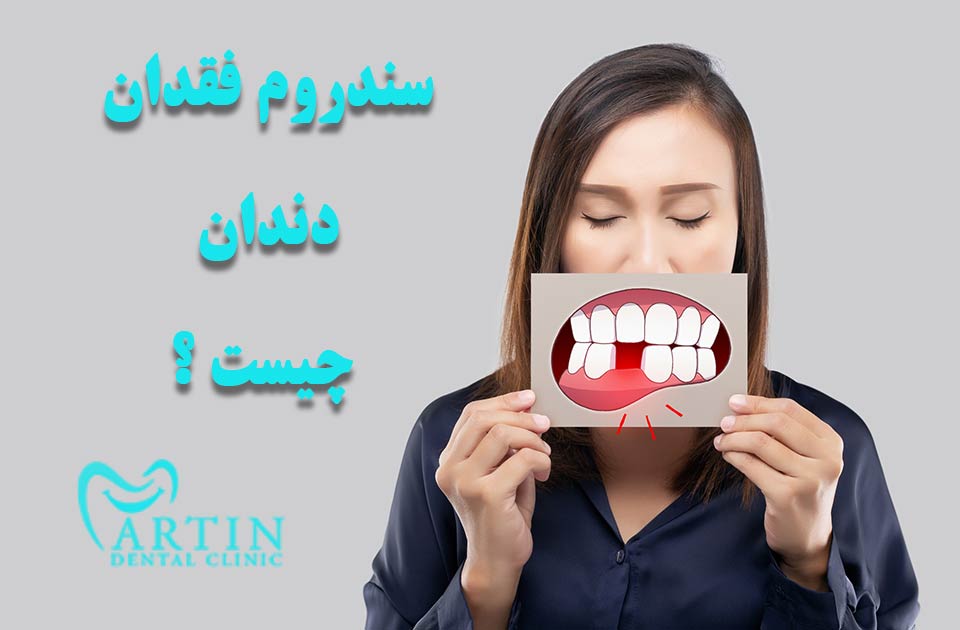 فقدان دندان چیست ؟