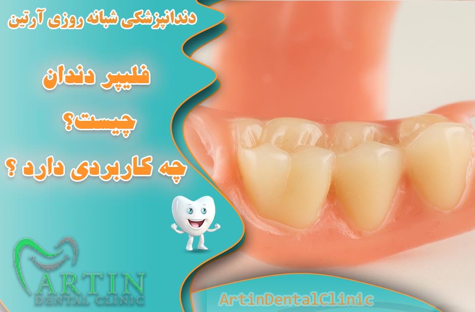 فلیپر دندان چیست ؟ چه کاربردی دارد ؟