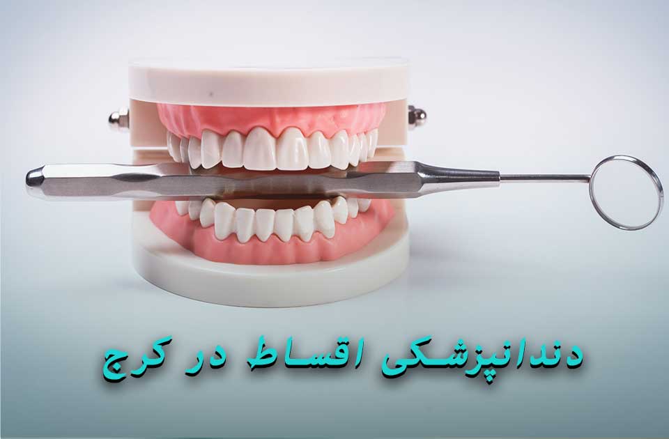 دندانپزشکی اقساط در کرج !