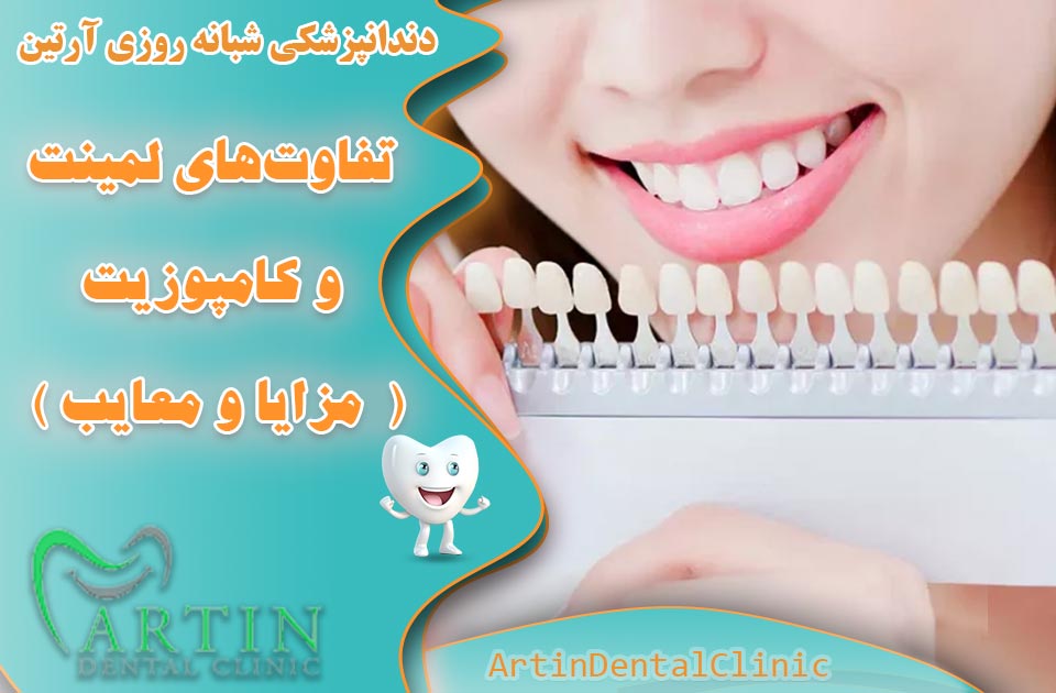 تفاوت‌های لمینت و کامپوزیت ( مزایا و معایب و بررسی جامع )