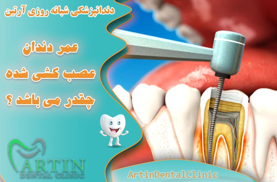 عمر دندان عصب کشی شده چقدر می باشد ؟