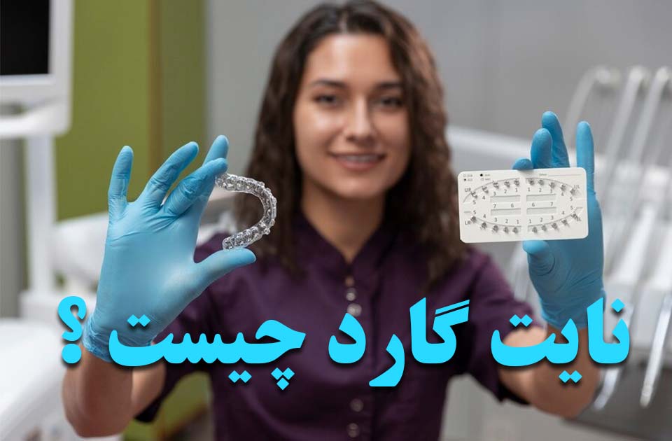 نایت گارد چیست ؟