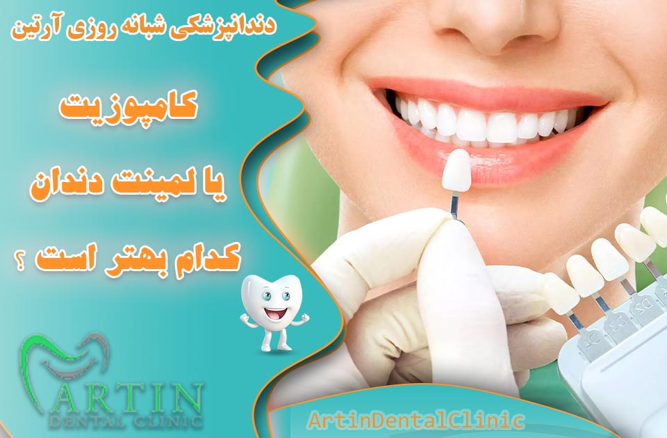 کامپوزیت یا لمینت دندان کدام یک بهتر است ؟