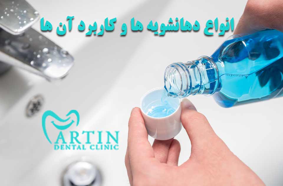 انواع دهانشویه ها و کابرد آن ها
