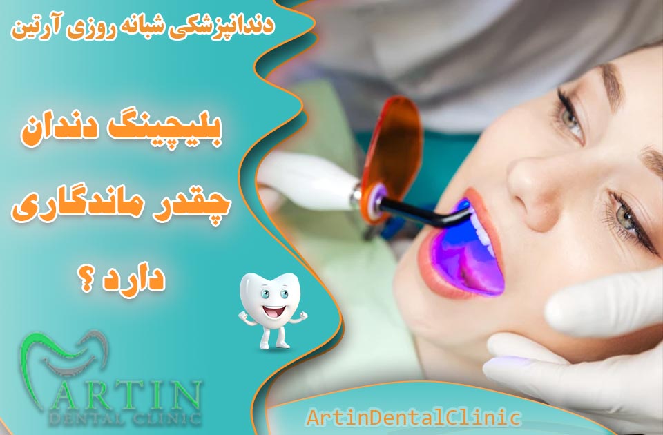 بلیچینگ دندان چقدر ماندگاری دارد ؟ ( مزایا و معایب )