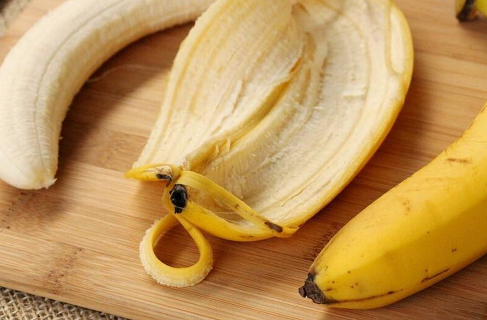 سفید کردن دندان با پوست موز