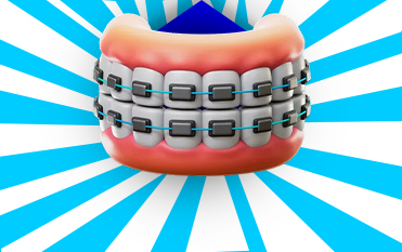 ارتودنسی دندان در کرج